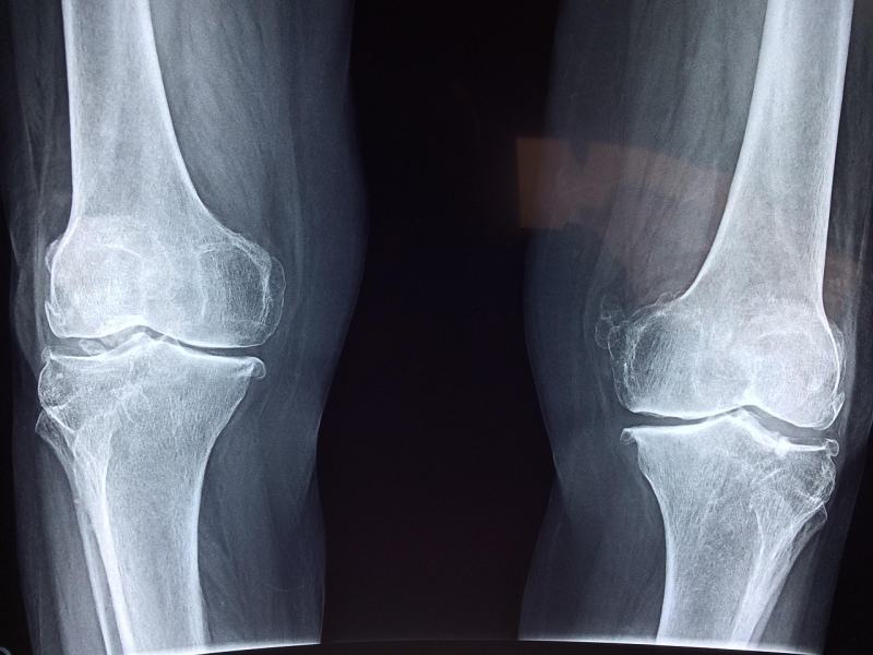 taokinesis-knee-2253047 1280