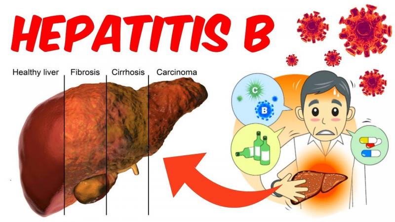 Hepatitis B Exposure