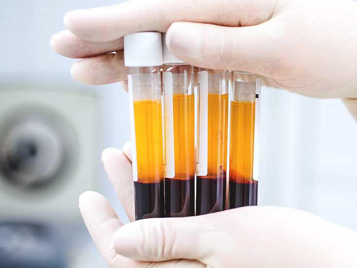 Platelet Rich Plasma/Stem Cell Therapy
